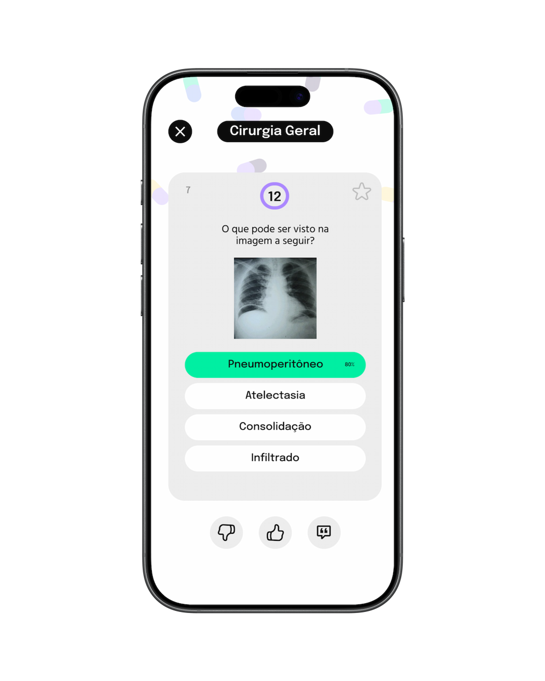 Tela de partida do MedPlay exibindo uma questão de residência médica com alternativas e cronômetro